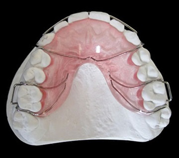 中国深圳3D打印正畸牙套工厂深圳义齿工厂出口到美国